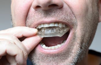 a man inserting mouthguards into his mouth