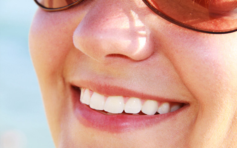 happy woman showing beautiful teeth after cosmetic bonding treatment in her smile