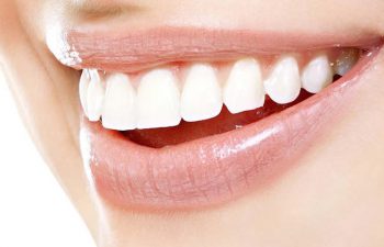 Perfect teeth after Invisalign treatment at Family Dentist in Rocky Hill, CT