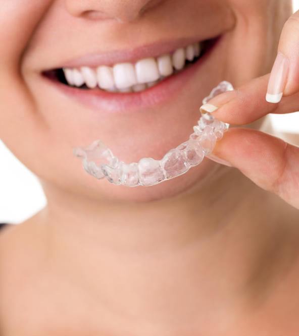 Invisalign aligner