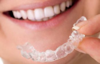 Invisalign aligner