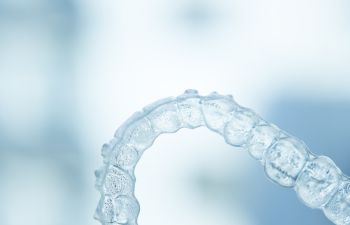 Clear Aligners